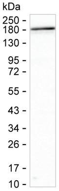 ARHGAP45